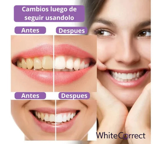 WhiteCorrect - Pasta dental blanqueadora