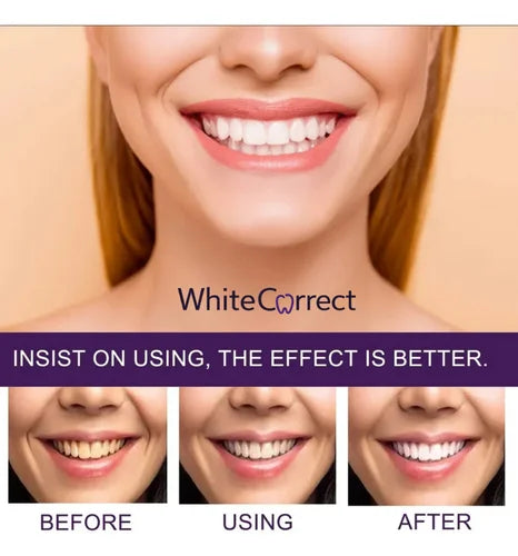 WhiteCorrect - Pasta dental blanqueadora